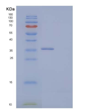 Recombinant Human Cyclin-D2/CCND2 Protein(N-6His)