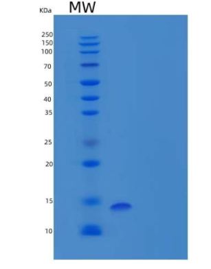 Recombinant Human Peptidyl-Prolyl Cis-Trans Isomerase FKBP2/FKBP22/FKBP13 Protein(C-6His)