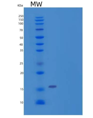 Recombinant Human 40S Ribosomal Protein S19/RPS19 Protein