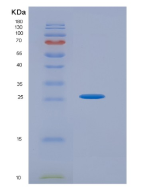 Recombinant Tumor Necrosis Factor Ligand Superfamily, Member 9 (TNFSF9)