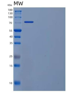 Recombinant Human Phosphofructokinase 1/PFKM/PFKX Protein(C-6His)