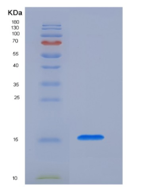 Recombinant Human PH-Like Domain A2/PHLDA2/BWR1C/IPL/TSSC3 Protein(C-6His)