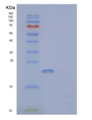 Recombinant Human Ubiquitin-Conjugating Enzyme E2 B/UBE2B/HR6B Protein
