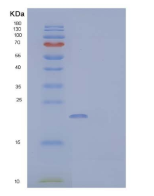 Recombinant Human Fatty Acid-Binding Protein 5 Protein