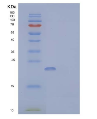 Recombinant Human Cytoglobin/CYGB Protein(C-6His)