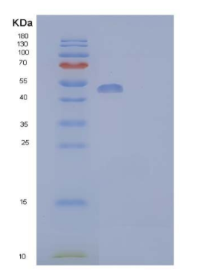 Recombinant Human Aldehyde dehydrogenase family 3 member A1 Protein