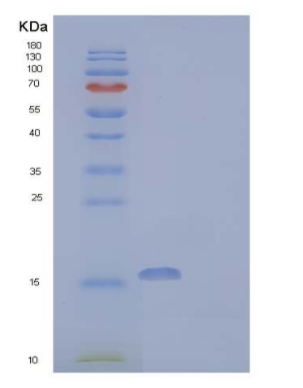 Recombinant Human Acyl-Coenzyme A Thioesterase 13/ACOT13 Protein(C-6His)