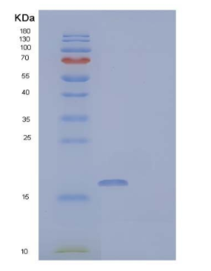 Recombinant Human Fatty Acid-Binding Protein 3 Protein