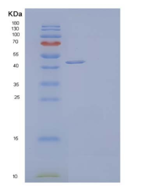 Recombinant Human Deoxyhypusine Synthase/DHS Protein(C-6His)