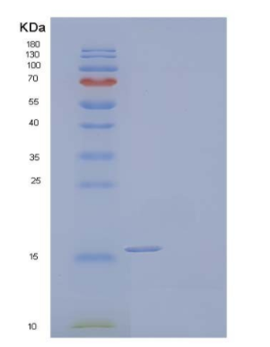 Recombinant Human Allograft Inflammatory Factor 1/AIF1 Protein(C-6His)