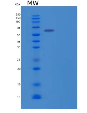 Recombinant Human Butyrylcholine Esterase Protein