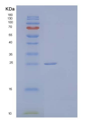 Recombinant Human Ribulose-Phosphate 3-Epimerase Protein