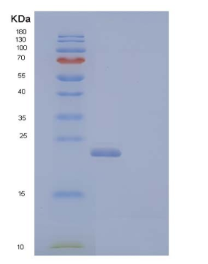 Recombinant Human Interleukin-4 Receptor Subunit Alpha/IL-4 Rα Protein(C-6His)