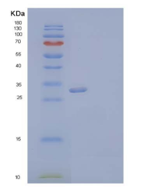 Recombinant Human VIP36-Like Protein/LMAN2L Protein(C-6His)