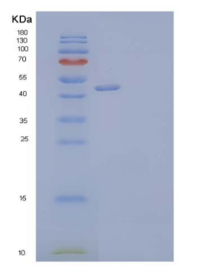 Recombinant Human Vascular Non-Inflammatory Molecule 2 Protein