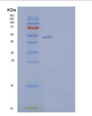 Recombinant Human Vitronectin/VTN Protein(C-6His)