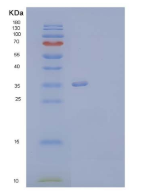 Recombinant Human Annexin A13/ANXA13 Protein