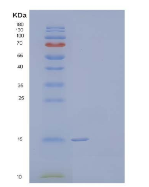 Recombinant Human Prion-Like Protein Doppel/PRND Protein(C-6His)