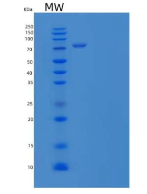 Recombinant Human Kelch-Like protein 41/Kell/CD238 Protein(C-6His)