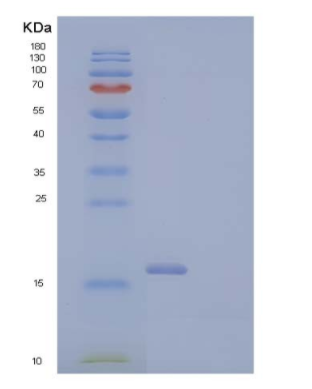 Recombinant Human Zymogen Granule Membrane Protein 16/ZG16 Protein(C-6His)