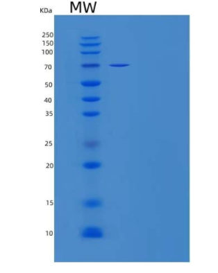 Recombinant Human ER α-1,2-Mannosidase/MAN1B1 Protein(C-6His)