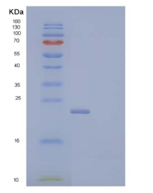 Recombinant Mouse Thymic Stromal Lymphopoietin Receptor/TSP R Protein(C-6His)