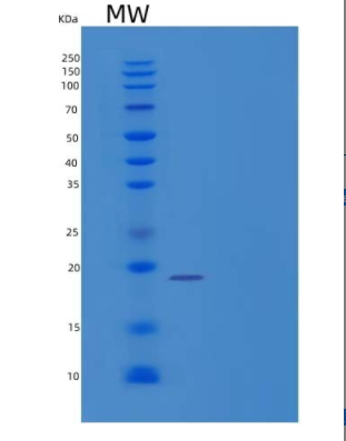 Recombinant Human Protein Kinase C Type ε/PKC ε/PKCE Protein(C-6His)