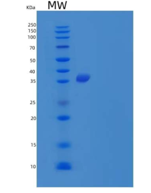 Recombinant Human α-N-Acetylneuraminide α-2,8-Sialyltransferase/ST8SIA1 Protein(C-6His)