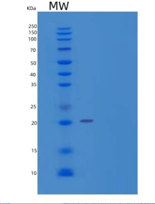 Recombinant Human Protein Phosphatase 1 Regulatory Subunit 1A/PPP1R1A Protein(C-6His)