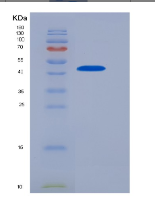 Recombinant Human CD32a / FCGR2A Protein (167 Arg, Fc tag)