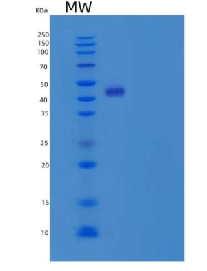 Recombinant Human β-Arrestin 1/ARRB1 Protein(C-6His)