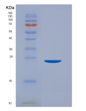 Recombinant Human CD32a / FCGR2A Protein (167 Arg, His & AVI tag)