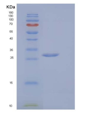 Recombinant Mouse V-Set and Ig Domain-Containing Protein 8/VSIG8 Protein(C-6His)