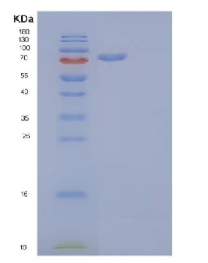 Recombinant Human Cadherin-16/CDH16 Protein(C-6His)