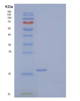 Recombinant Human Retinoic Acid Receptor Responder Protein 2/Chemerin/TIG2 Protein(C-6His)