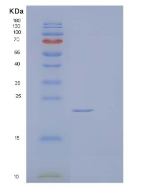 Recombinant Human Fibroblast Growth Factor 17/FGF-17 Protein(C-6His)