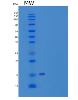 Recombinant Human Ribonuclease K6/RNASE6 Protein(C-6His)