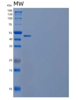 Recombinant Human Calnexin/CANX Protein(C-6His)