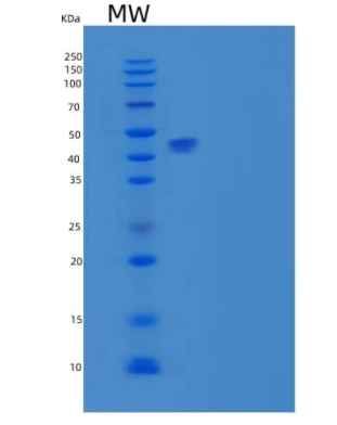 Recombinant Human Carboxypeptidase B2/CPB2 Protein(C-6His)