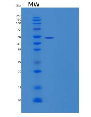 Recombinant Human Serpin A10/ZPI Protein(C-6His)