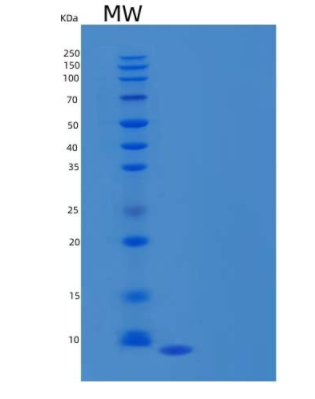 Recombinant Human C-C Motif Chemokine 3-Like 1/CCL3L1 Protein(C-6His)