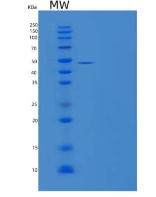 Recombinant Human Glutamate Oxaloacetate Transaminase 1/GOT1 Protein(C-6His)