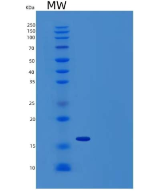 Recombinant Human Natural Killer Cells Antigen CD94/CD94 Protein(N-6His)