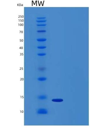 Recombinant Human Activin Receptor 2B/Activin RIIB/ACVR2B Protein(C-6His)