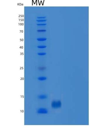 Recombinant Human B2M / Beta-2-microglobulin Protein (His tag)