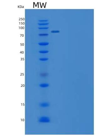 Recombinant Mouse EphB4 / HTK Protein (Fc tag)(Fc tag)