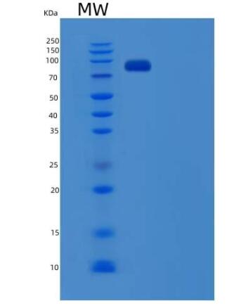 Recombinant Human USP5 / ISOT Protein (His tag)