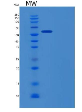 Recombinant Human EphB6 / EphB6 Protein (His tag)