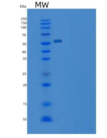 Recombinant Rat IL7R / IL7RA Protein (Fc tag)