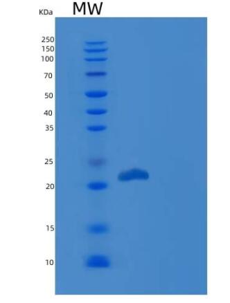 Recombinant Human GH1 / Growth hormone 1 Protein